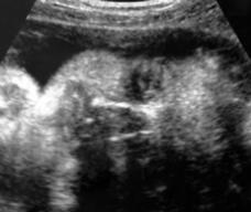 怀孕220天胎儿图