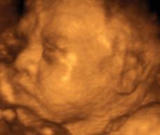 怀孕221天胎儿图