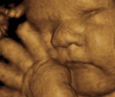 怀孕269天胎儿图
