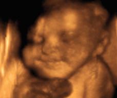 怀孕226天胎儿图