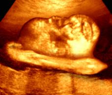 怀孕228天胎儿图