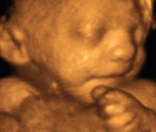 怀孕229天胎儿图