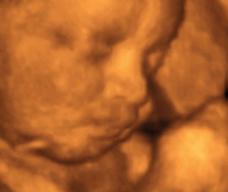 怀孕230天胎儿图