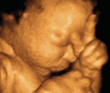 怀孕232天胎儿图