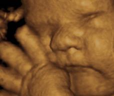 怀孕272天胎儿图