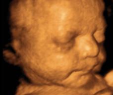 怀孕233天胎儿图