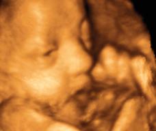 怀孕236天胎儿图