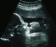 怀孕238天胎儿图