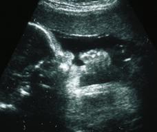 怀孕241天胎儿图