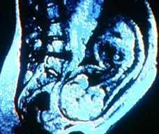 怀孕242天胎儿图