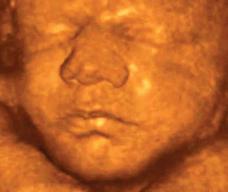 怀孕245天胎儿图