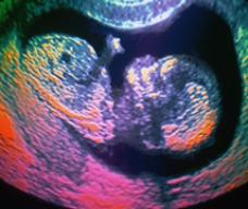 怀孕247天胎儿图