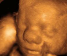 怀孕248天胎儿图