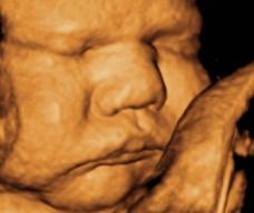 怀孕264天胎儿图